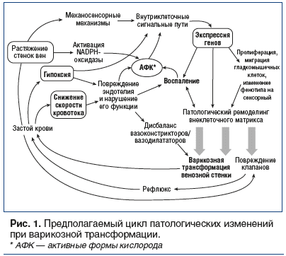 Рис. 1. Предполагаемый цикл патологических изменений при варикозной трансформации.