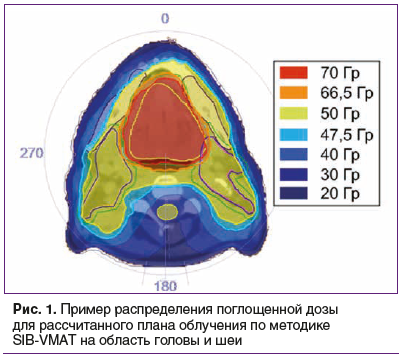 Рис. 1. Пример распределения поглощенной дозы для рассчитанного плана облучения по методике SIB-VMAT на область головы и шеи